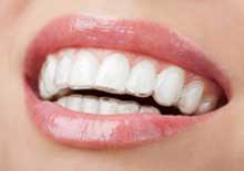 Ortodonzia invisibile Manduria